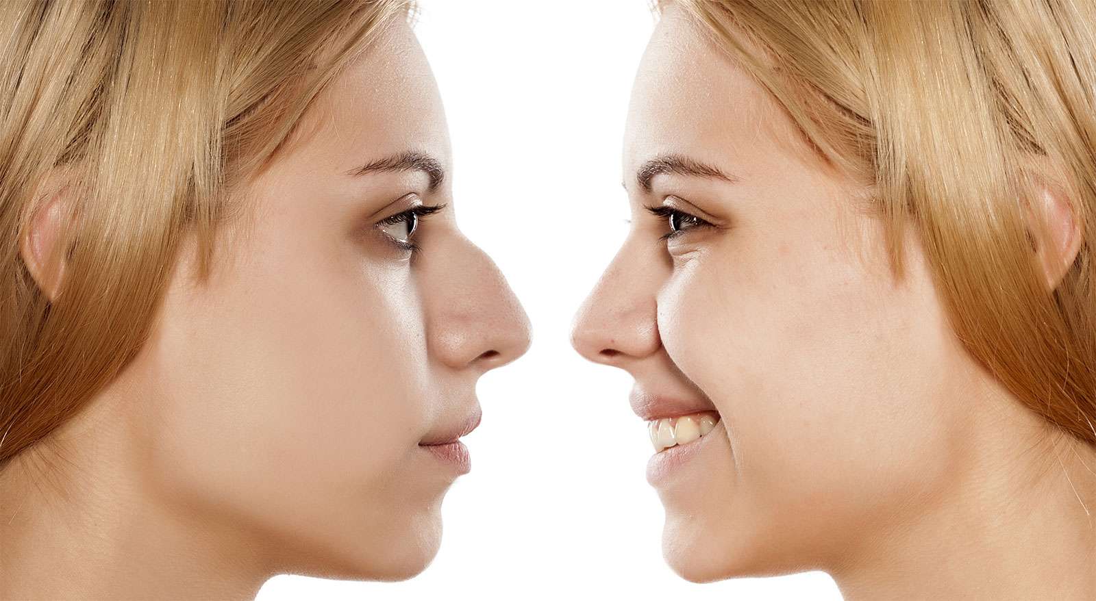 Cosmetic Rhinoplasty Surgeons Philadelphia