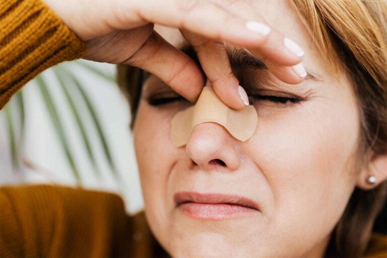 Woman with a broken nose